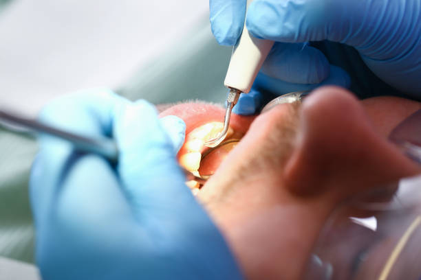 Emergency Dental Filling Replacement in ME